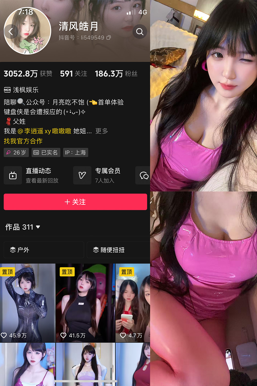 抖音 清风皓月 微密圈 | 觅圈 NO.003期 【18P6V】最新至:2025.5.25 抖音 清风皓月 微密圈 | 觅圈 NO.003期 【18P6V】最新至:2025.5.25