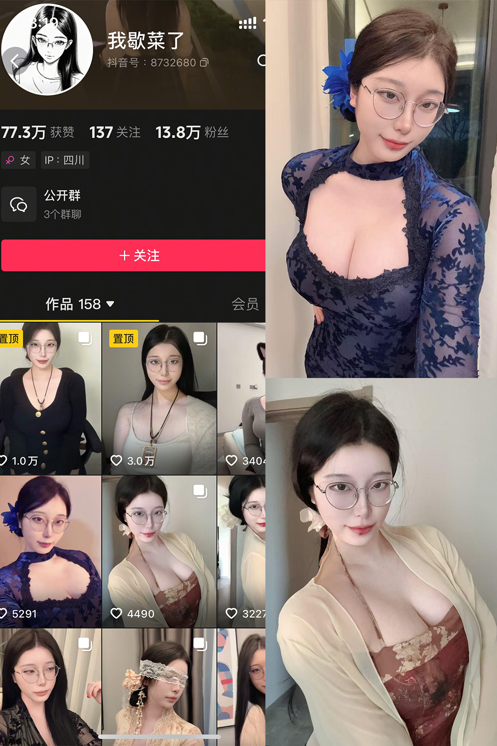抖音 我歇菜了 微密圈 NO.001期 【10P】最新至:2025.4.19 抖音 我歇菜了 微密圈 NO.001期 【10P】最新至:2025.4.19